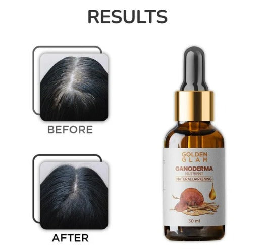 Anti Greying Hair Serum (30 ml) 18277
