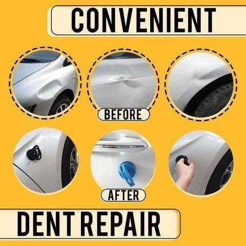 Dent Puller- Advance Dent Puller (Assorted Colour) m2wvuk-pc