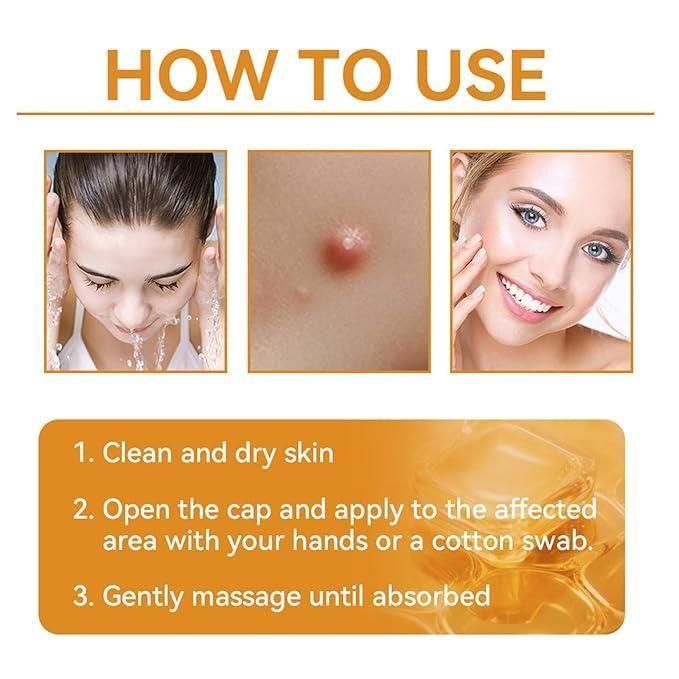Bee Venom Skin Treatment Cream 100g (Pack of 2) m2wvuk-pc